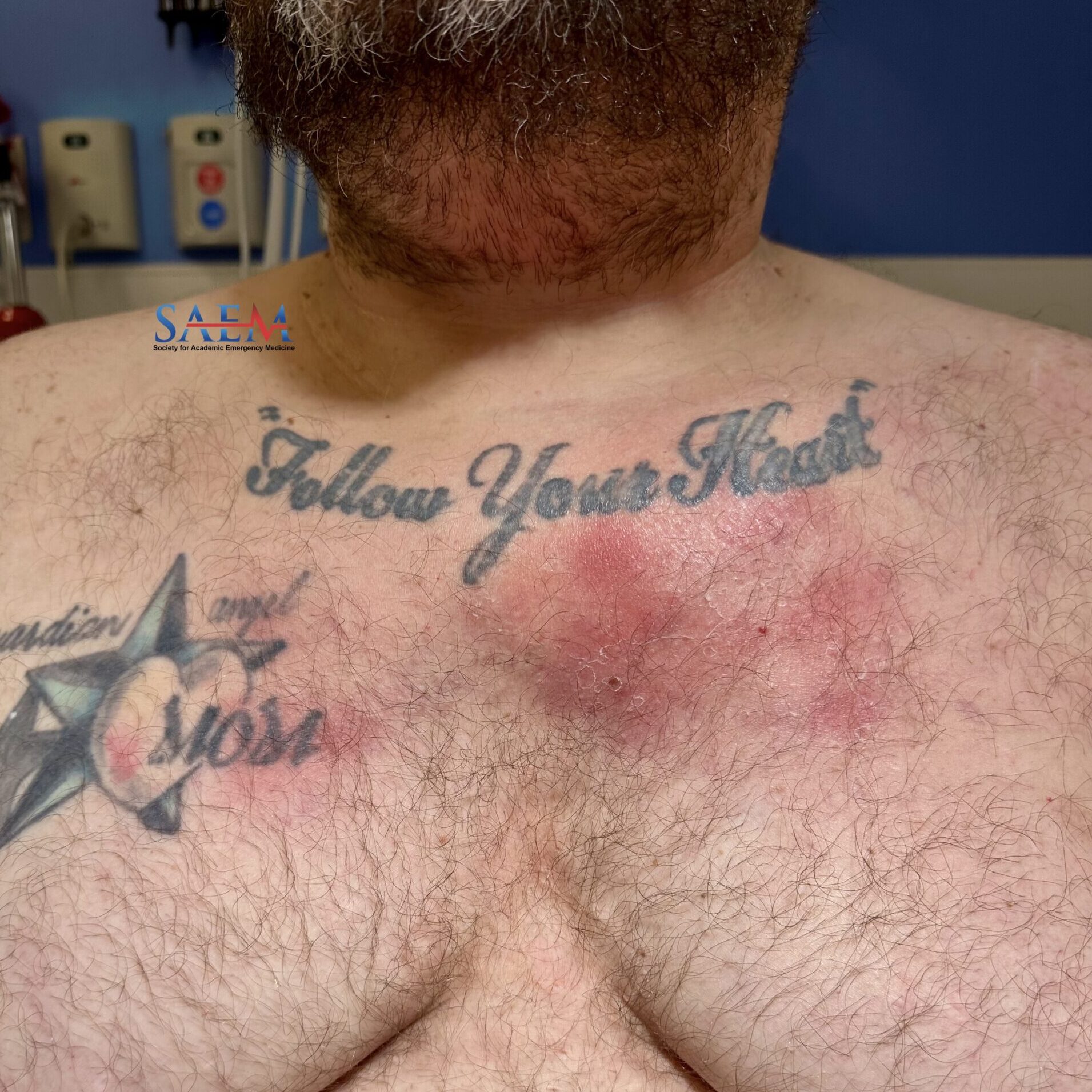 Do chest tattoos hurt? - Quora