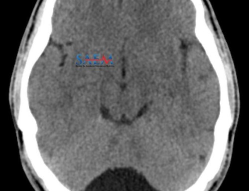 SAEM Clinical Images Series: Intracranial Abnormality