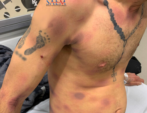 SAEM Clinical Images Series: Man with a Recurrent Rash
