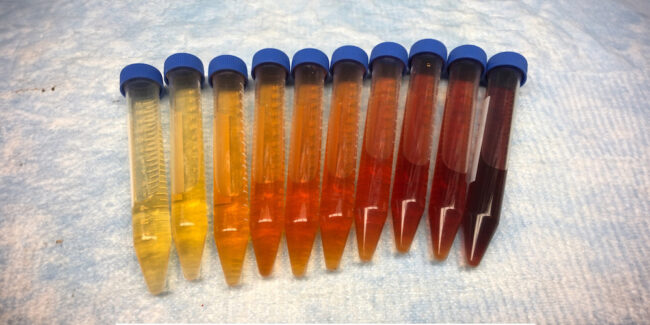 test tube of different color urine