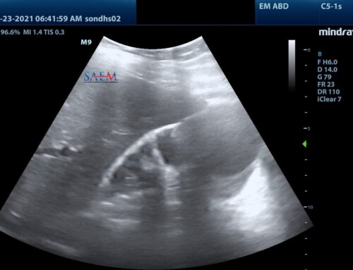 SAEM Clinical Images Series: Utility of Bedside Ultrasonography