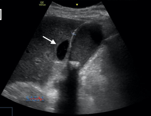 SAEM Clinical Images Series: An Ultrasonographic Rabbit Hole