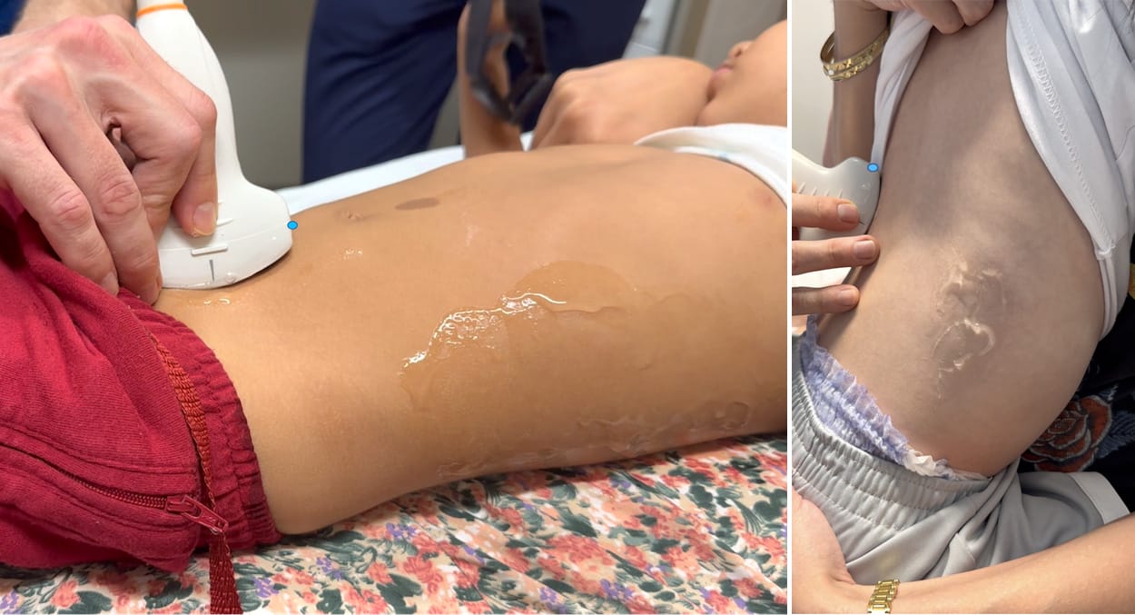 pediatric ultrasound positioning
