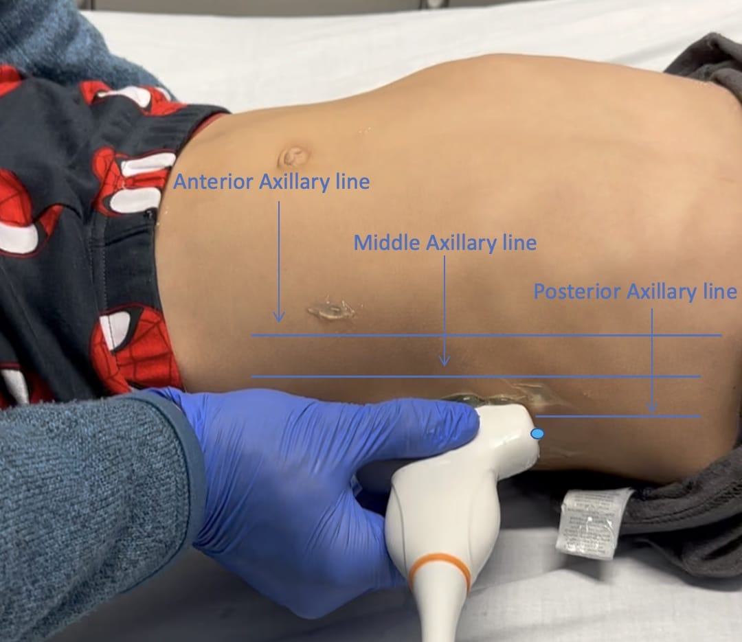 left kidney longitudinal ultrasound probe position