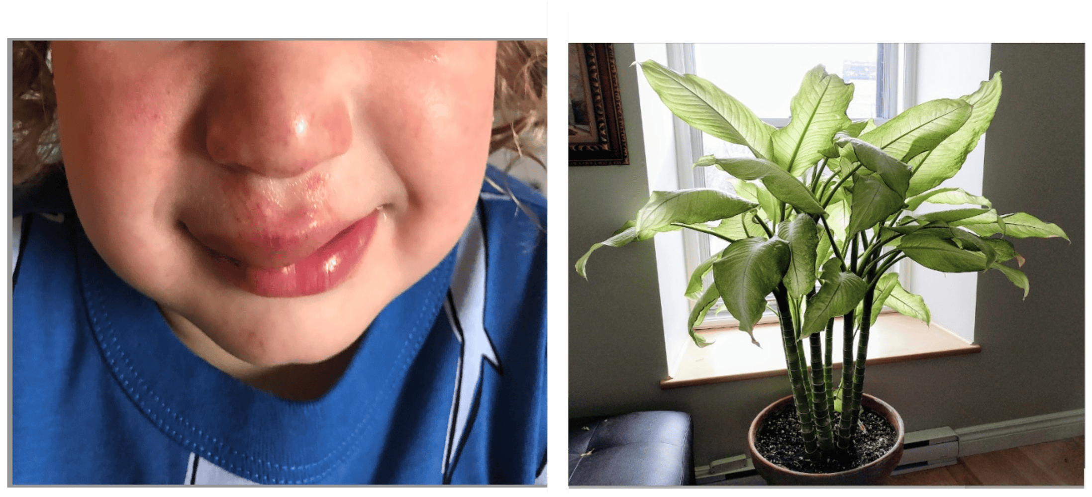 dumbcane