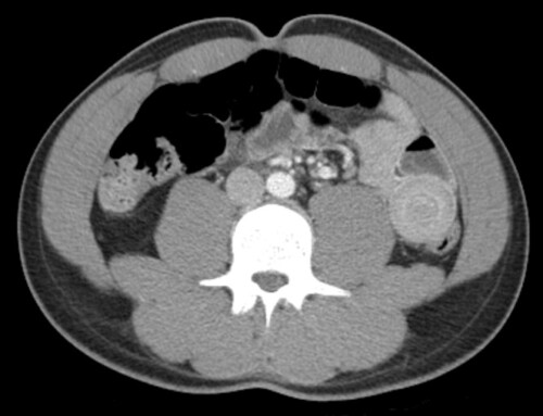 Diagnosis on Sight: “Stabbing Belly Pain”