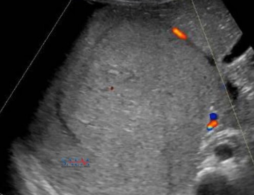 SAEM Clinical Images Series: Wilma, Take a Look at This!