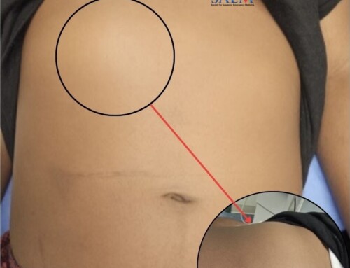 SAEM Clinical Images Series: When it is Not Just a Knot