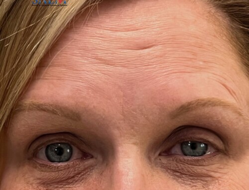 SAEM Clinical Images Series: Ptosis? A Don’t Miss Diagnosis!