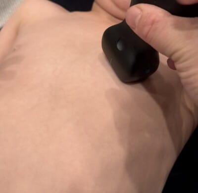 Figure 2 PSLA probe placement