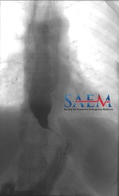 esophagram