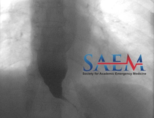 SAEM Clinical Images Series: There’s a Bird Stuck in Your Throat