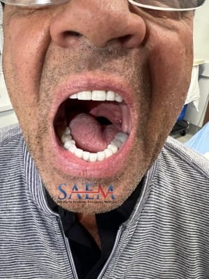 tongue