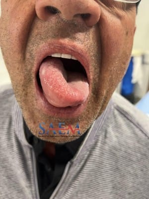 tongue