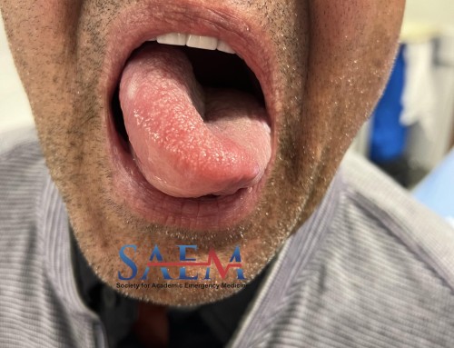 SAEM Clinical Images Series: Tongue Twisters