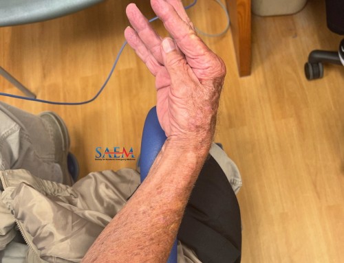 SAEM Clinical Images Series: Caught by the Cuff