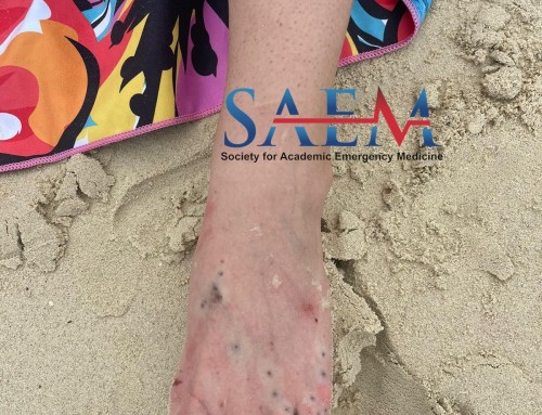 SAEM Clinical Images Series: Snorkeling Gone Wrong!
