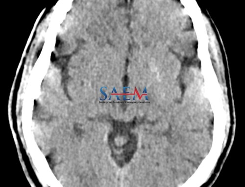 SAEM Clinical Images Series: I Cannot Control My Right Side