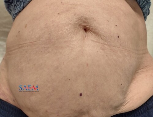 SAEM Clinical Images Series: Pain, Paralysis, and Rash