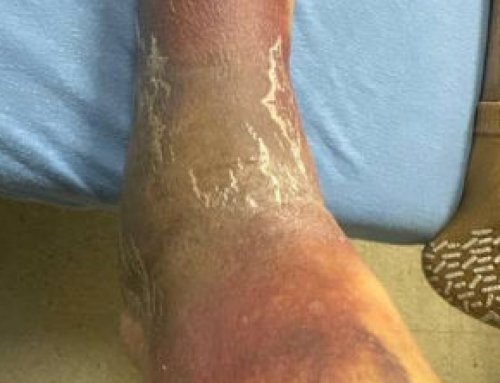 SAEM Clinical Images Series: Modern Pirate