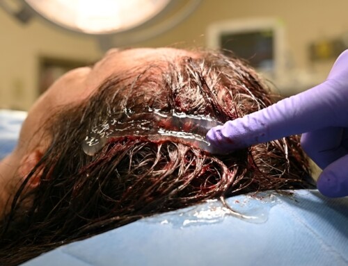 Trick of Trade: Using Sterile Lubricating Gel to Manage Bloody Scalp Lacerations | A Simple Gel, a Big Fix