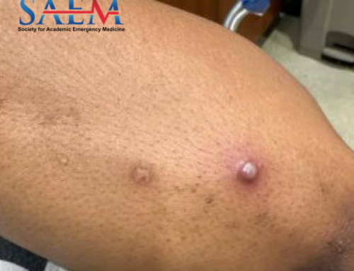 SAEM Clinical Images Series: Connect the Dots