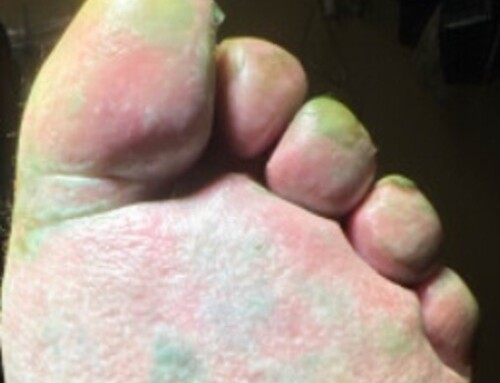 SAEM Clinical Images Series: Green Foot