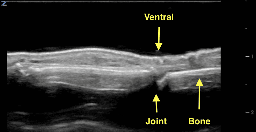 Normal finger phalanx imaged with water bath technique