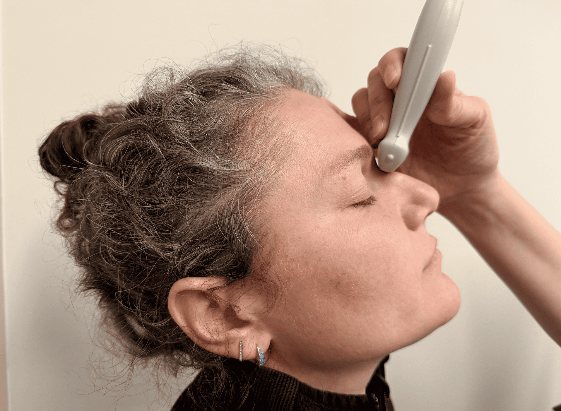 Linear ultrasound probe positioning to evaluate for a pediatric nasal fracture