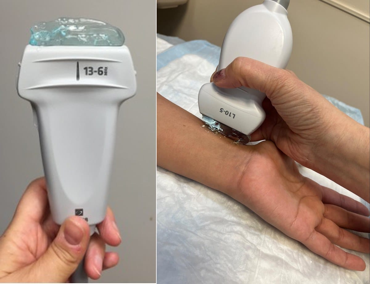Linear probe with gel and floating probe technique