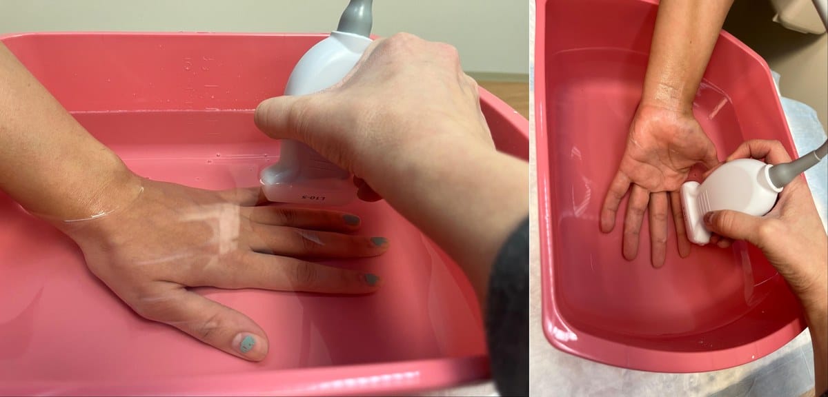 Water bath technique to image a phalanx dorsally and ventrally with the submerged probe floating above the hand