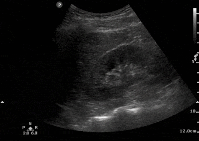 Figure 5a