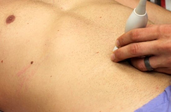 Curvilinear-probe-on-abdomen 550