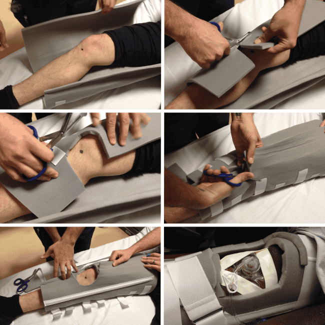 Tibial IO Immobilizer How-to