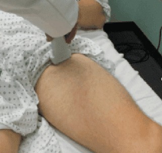 ultrasound dvt
