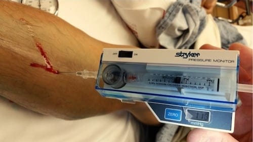 Stryker compartment