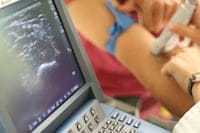 ultrasound guided peripheral iv